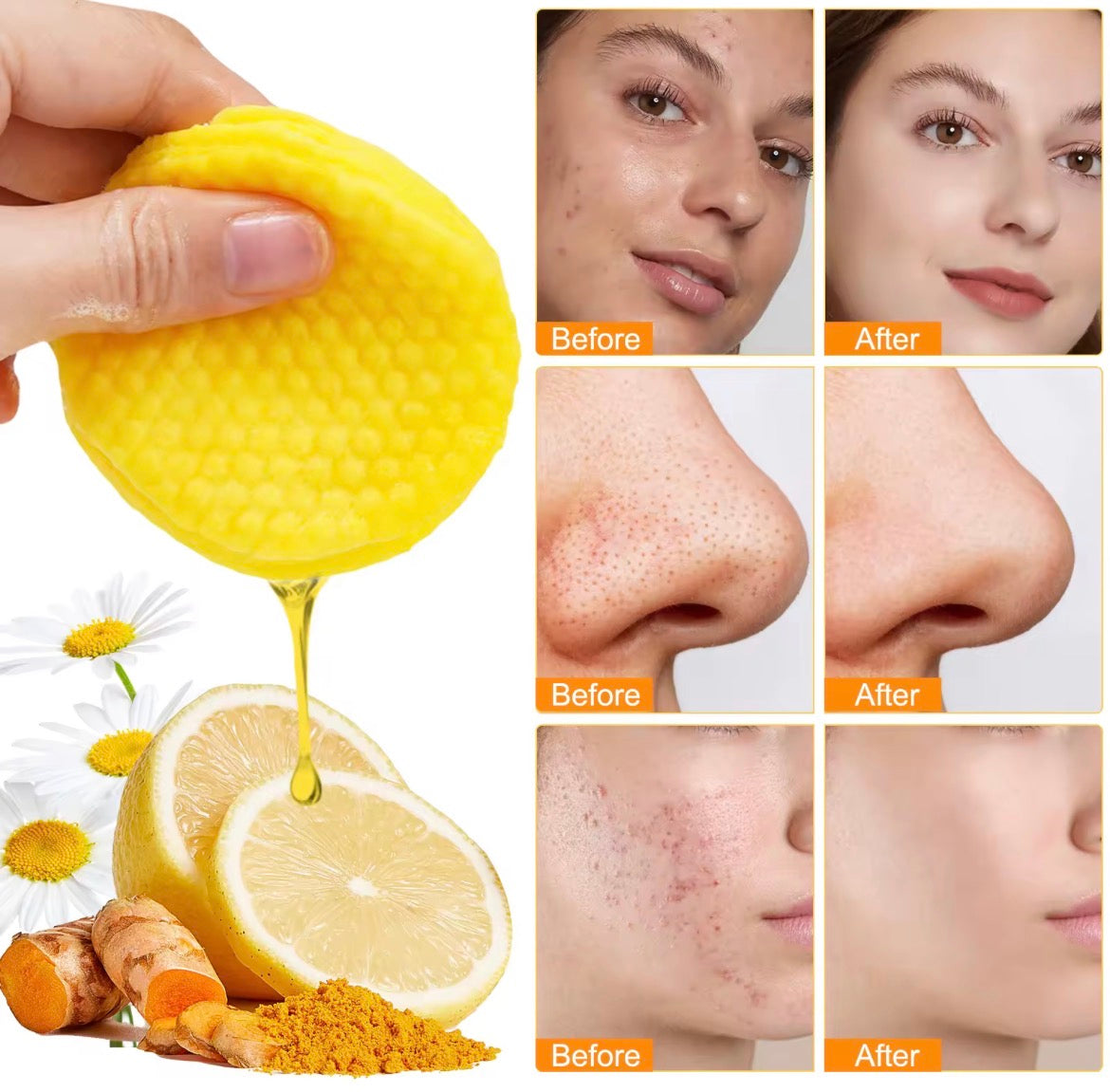 KOJIC ACID & TURMERIC CLEANSING PADS